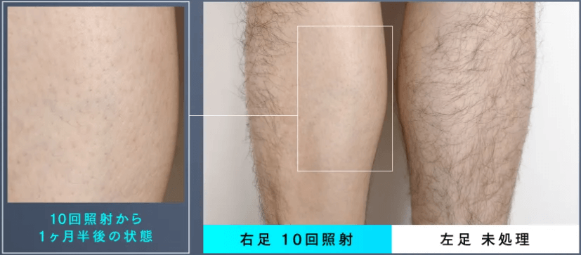 1㎠あたりの最大出力(ミライのほうが強い)