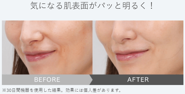 ホワイトフォト(DOL)