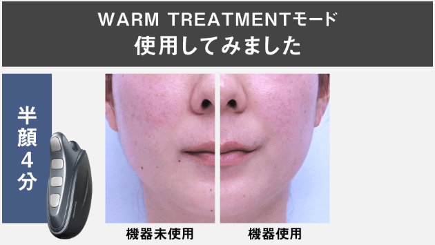 WARM TREATMENTモード(ウォームトリートメントモード)の効果