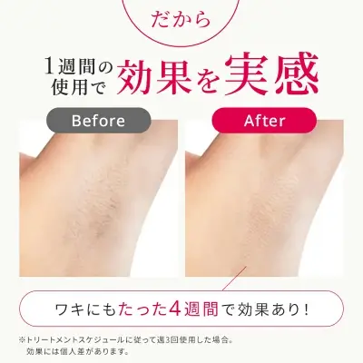 Ulike Air10の特長