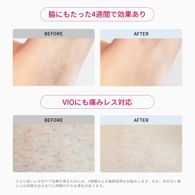 Ulike Air3の特長