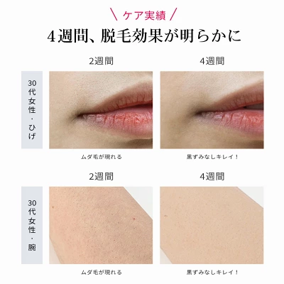 Ulike Air3の特長