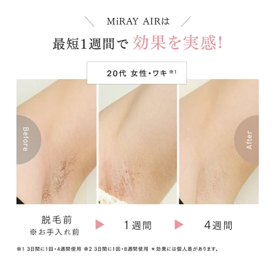 マイトレックスミライAirの特長