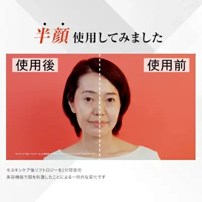 新型リフトロジーSPの特長