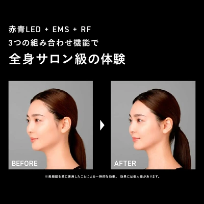 エレキブラシプラスの特長