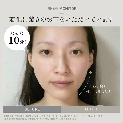 マイトレックスプルーヴの特長